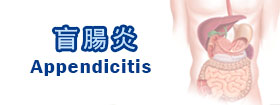 盲腸炎