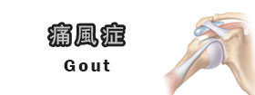 痛風症