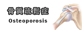 骨質疏鬆症
