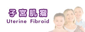 子宮肌瘤