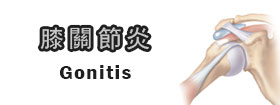 膝關節炎