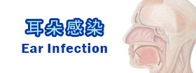 耳朵感染