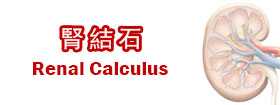 腎結石