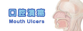 口腔潰瘍