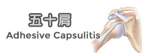 五十肩
